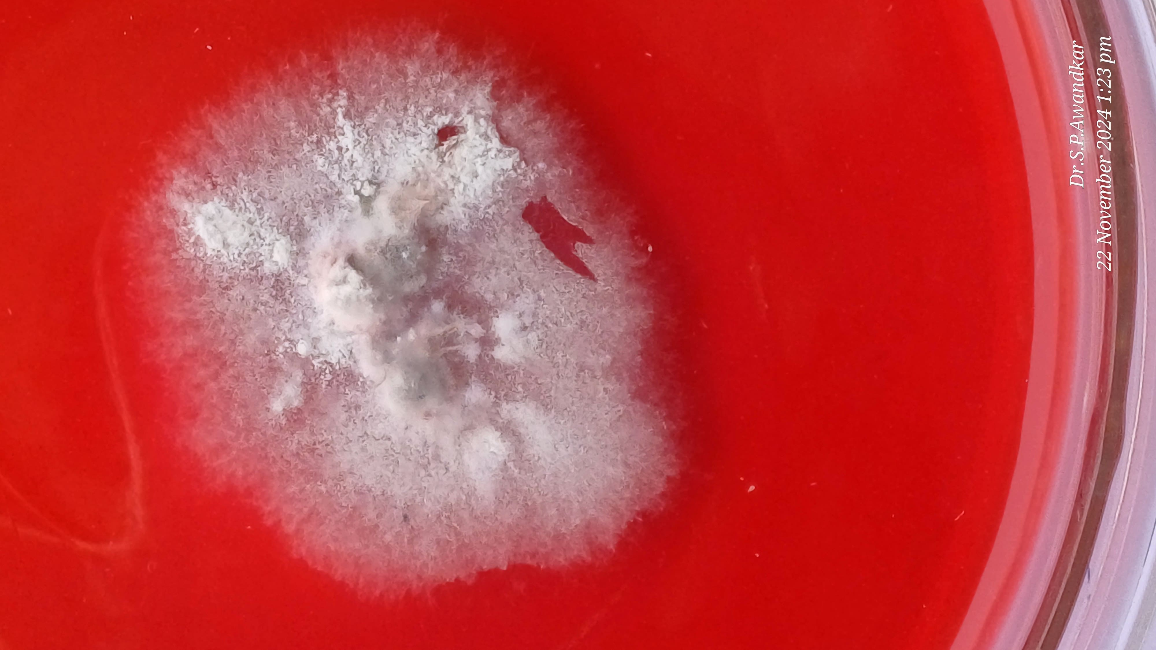 32. Trichophyton Mentagrophytes